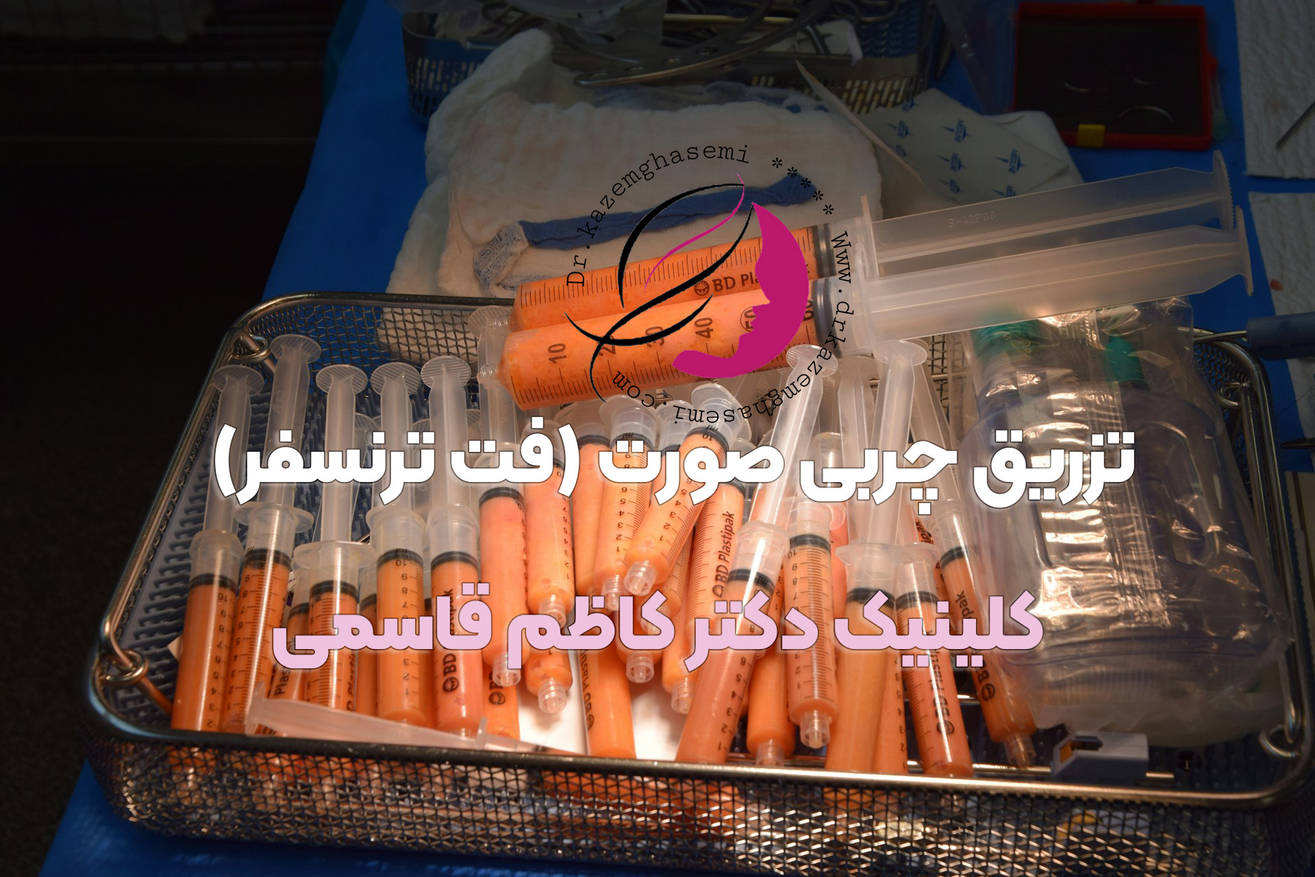 تزریق چربی صورت (فت ترنسفر)