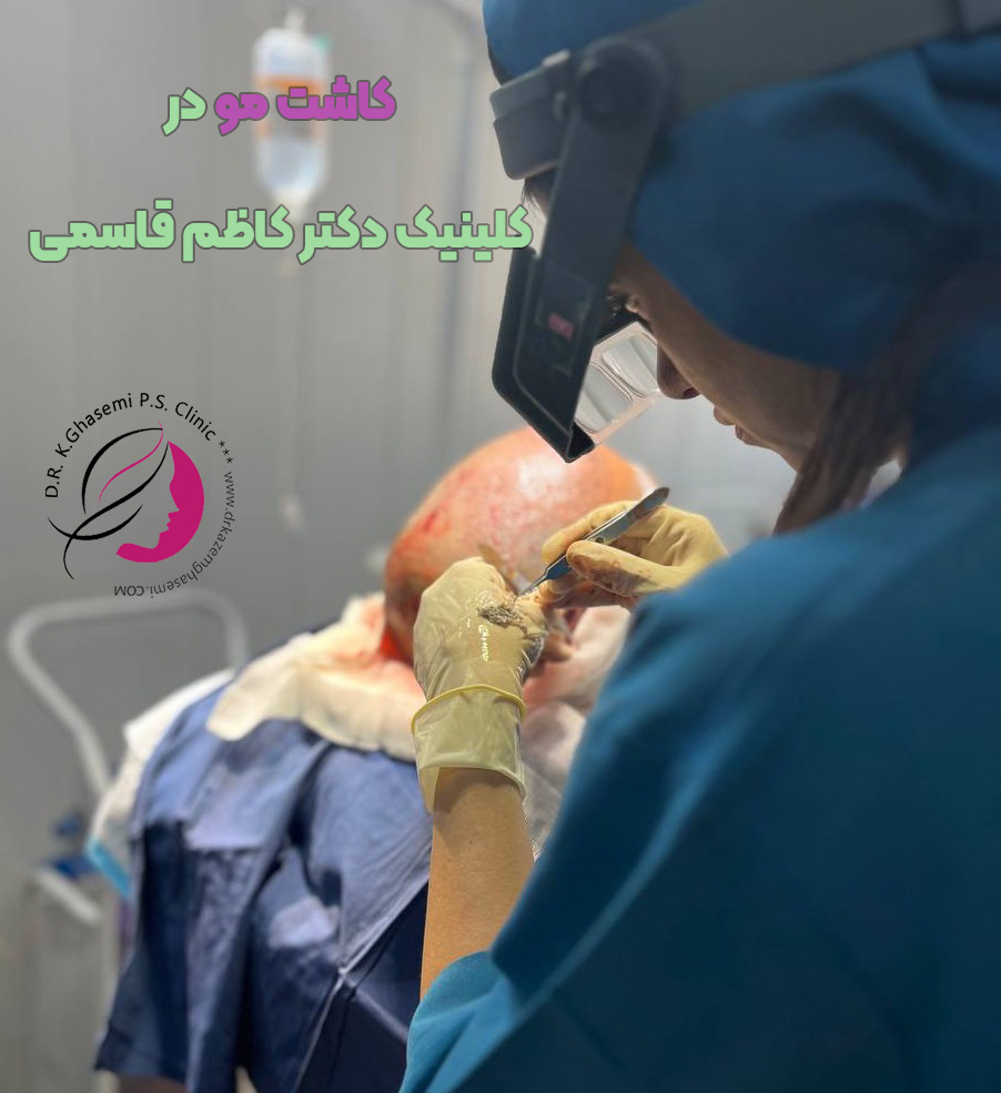 علت اصلی ریزش مو در مردان + نقش تغذیه در درمان ریزش