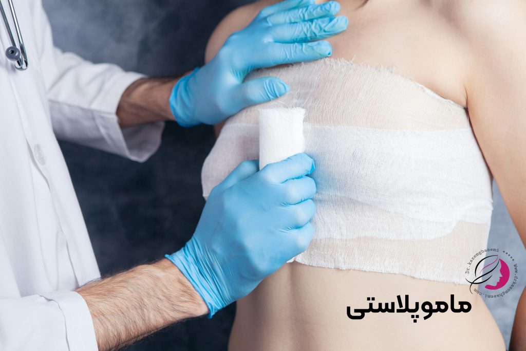 بهبودی بعد از ماموپلاستی راهنمای کامل