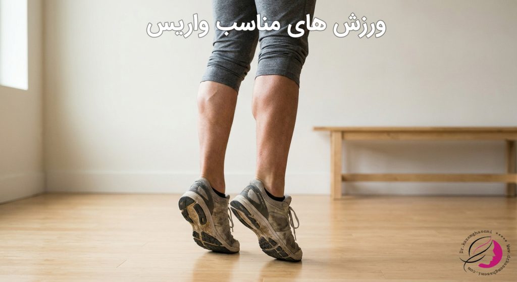 بلند کردن پاشنه پا جهت بهبود واریس