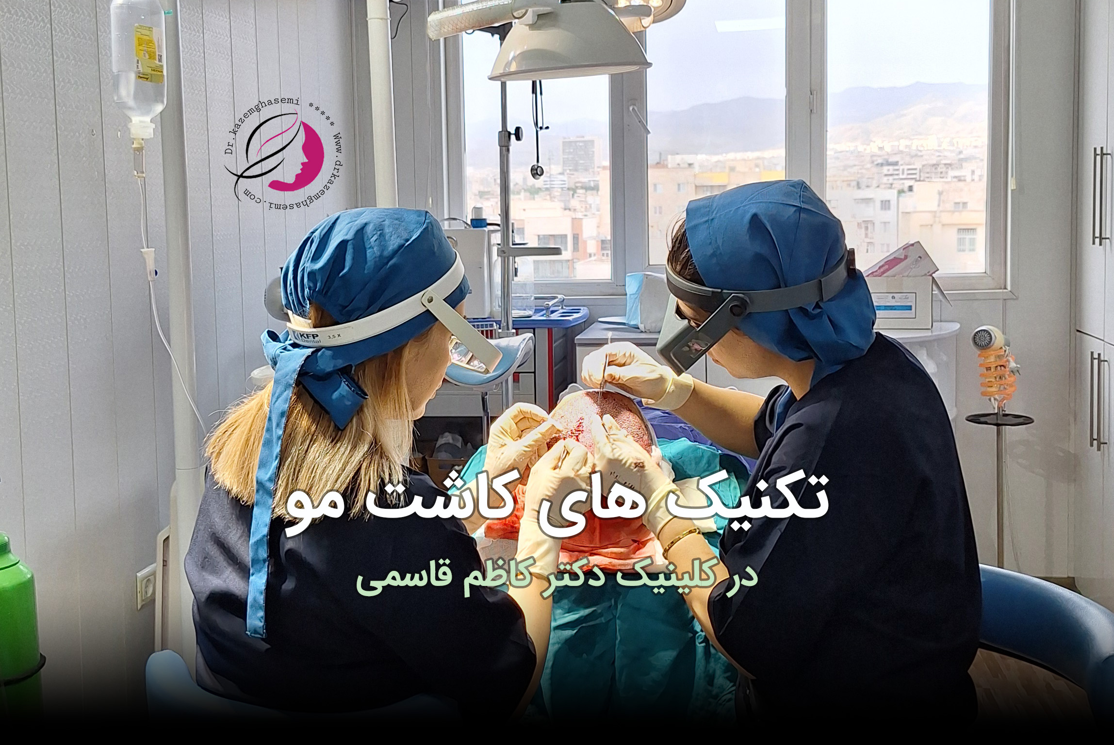 کاشت مو در کرج | روش SUT و FUT + قیمت ۱۴۰۵کاشت مو