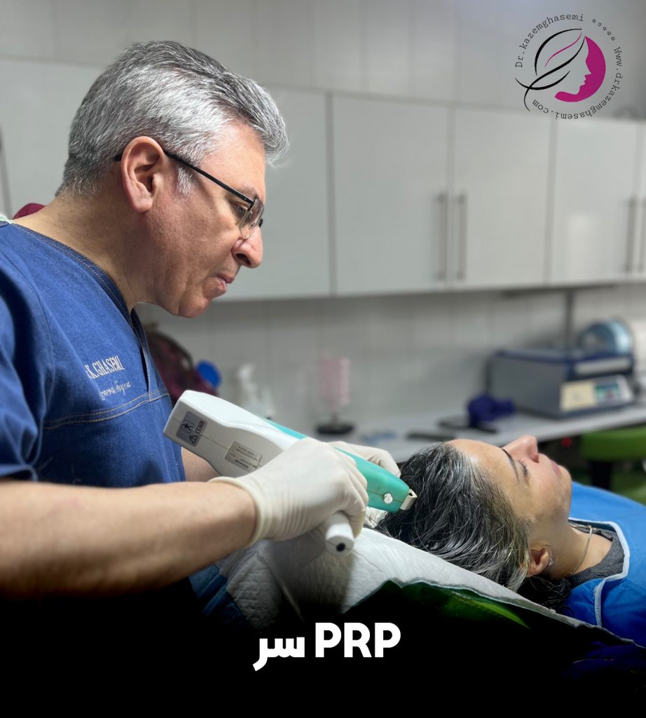 پی ار پی موی سر