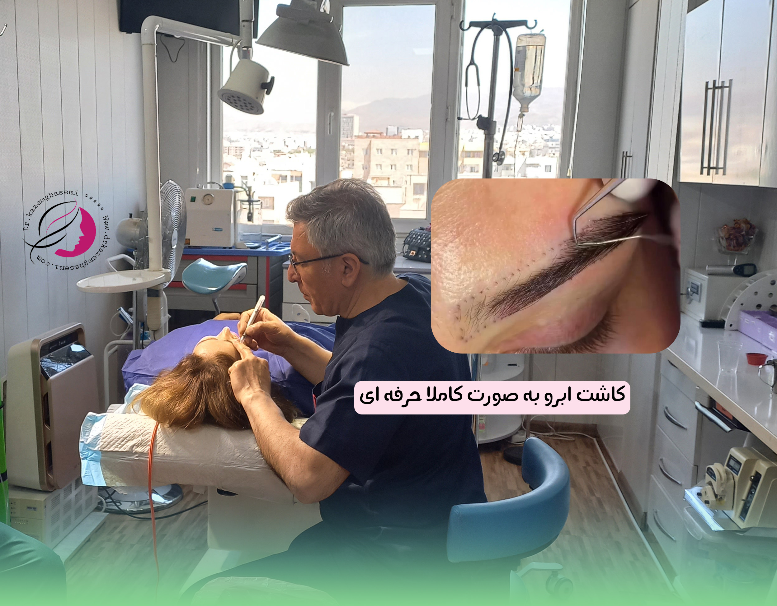 کاشت ابرو دائمی | روشها، هزینه و نکات کلیدی ۱۴۰۵