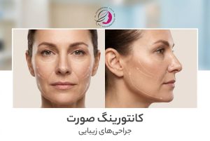 کانتورینگ صورت،روش ها مزایا و هزینه